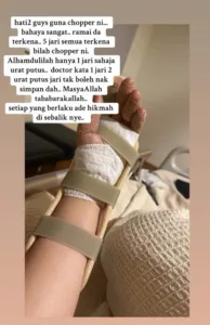 Bahaya Chopper Makan Tuan, Nak Betulkan Bilah Tercabut Wanita Putus 2 Urat Jari
